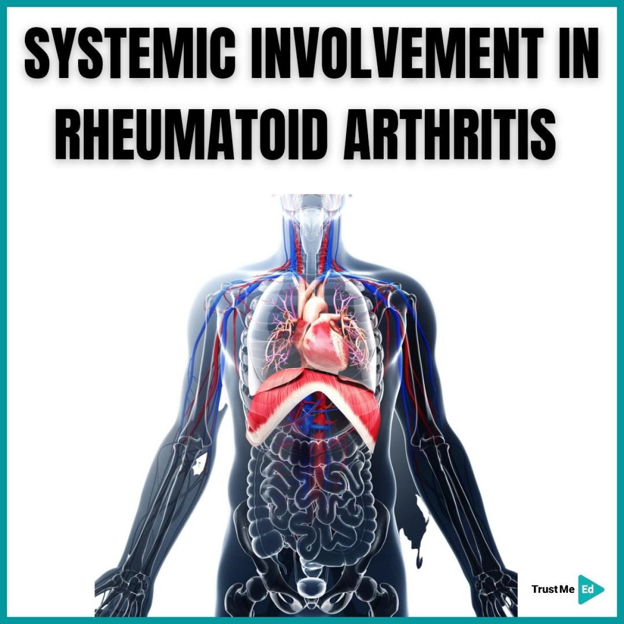 SYSTEMIC INVOLVEMENT IN RHEUMATOID ARTHRITIS