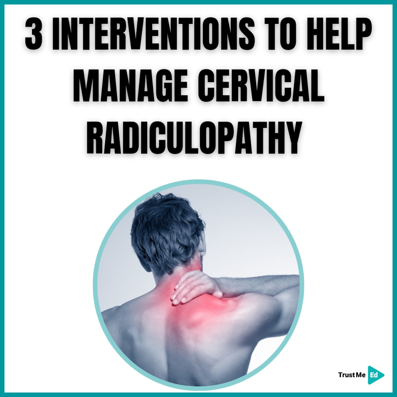 3 INTERVENTIONS TO HELP MANAGE CERVICAL RADICULOPATHY